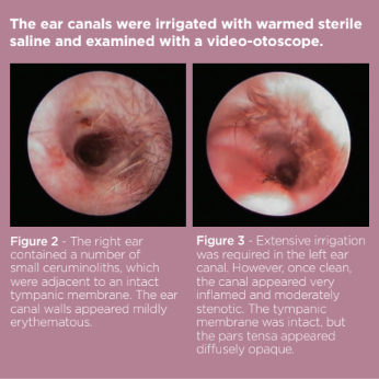 Otitis externa in sales dogs home treatment